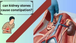 can kidney stones cause constipation?